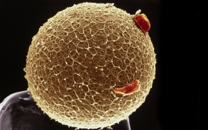 B0002100 Human egg with coronal cells - gold